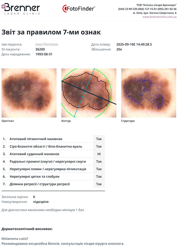 Анализ подозрительного новообразования с помощью ИИ