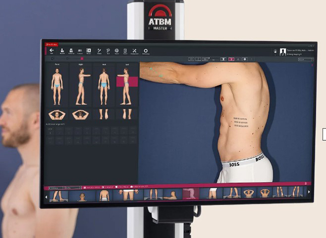 Карта родимок