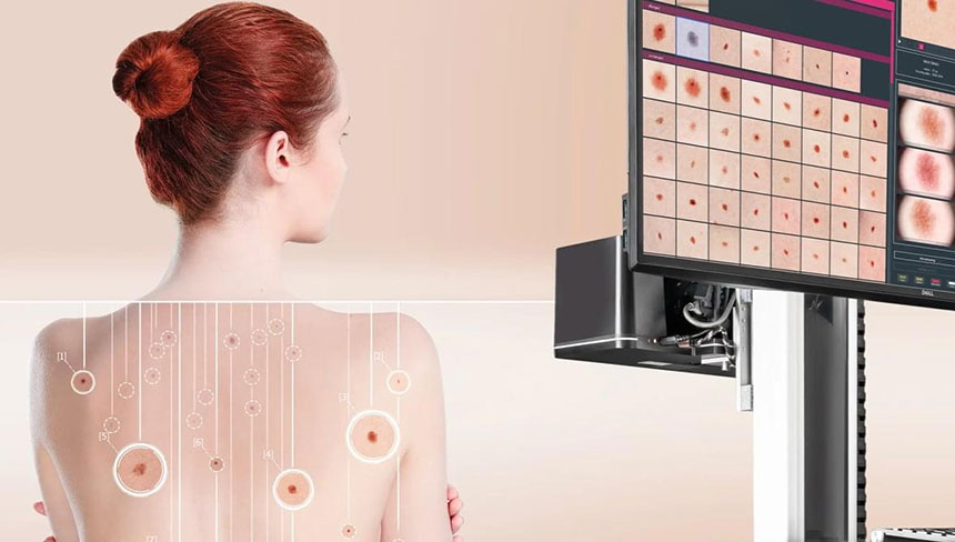 Цифровая электронная дерматоскопия в Киеве - убедитесь в безопасности своих родинок!