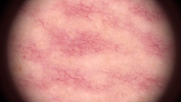 Микроснимок участка №04 (увелич. х20)