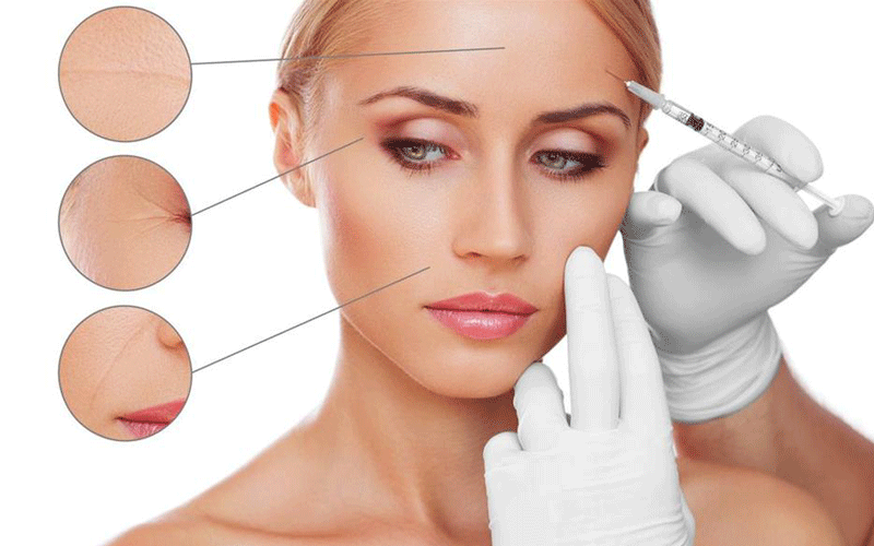 Поширені зони застосування препаратів ВТА на обличчі